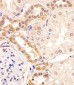 PKC beta1/2 Antibody (Center)